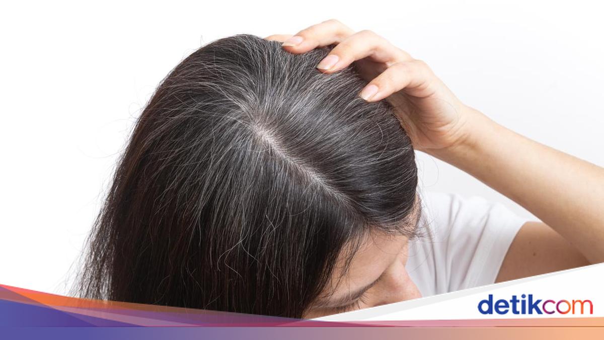 Apakah Uban Menjadi Tanda Tubuh Melawan Kanker? Simak Penjelasan Dosen IPB